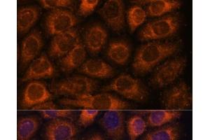 Immunofluorescence analysis of HeLa cells using CCT6B Polyclonal Antibody at dilution of 1:100. (CCT6B 抗体)