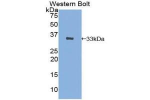Detection of Recombinant AE1, Human using Polyclonal Antibody to Band 3 (BND3) (Band 3/AE1 抗体  (AA 35-290))