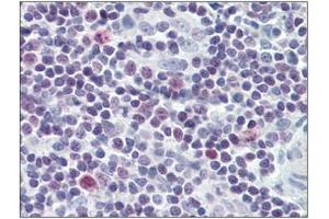 Human Tonsil: Formalin-Fixed, Paraffin-Embedded (FFPE) (Survivin 抗体)