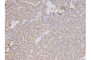 Immunohistochemistry (IHC) image for anti-Thymopoietin (TMPO) antibody (ABIN1875122) (Thymopoietin 抗体)