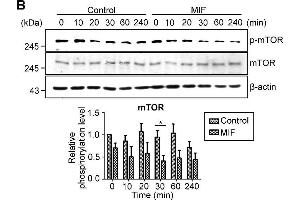 MIF facilitates autophagy induction in endothelial cells.