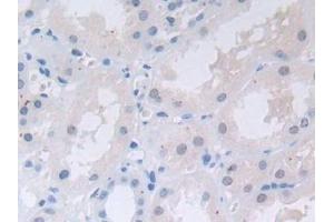 Immunohistochemistry (IHC) image for anti-Transferrin Receptor 2 (TFR2) (AA 4-87) antibody (ABIN7431464)