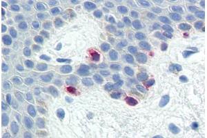 Human Skin, Melanocytes (formalin-fixed, paraffin-embedded) stained with MLANA antibody ABIN573958 at 10 ug/ml followed by biotinylated goat anti-rabbit IgG secondary antibody ABIN481713, alkaline phosphatase-streptavidin and chromogen. (MLANA 抗体  (C-Term))