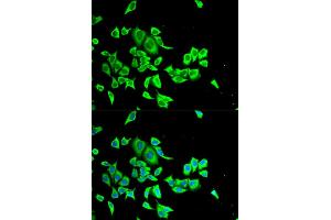 Immunofluorescence analysis of HeLa cells using SERPINB1 antibody. (SERPINB1 抗体)