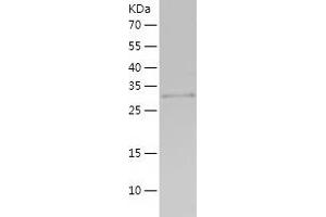C1q and Tumor Necrosis Factor Related Protein 3 (C1QTNF3) (AA 23-319) protein (His-IF2DI Tag)