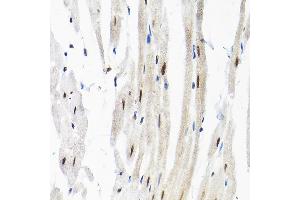 Immunohistochemistry of paraffin-embedded rat heart using SNRPF Rabbit pAb (ABIN6132678, ABIN6148228, ABIN6148229 and ABIN6215753) at dilution of 1:200 (40x lens). (SNRPF 抗体  (AA 1-86))