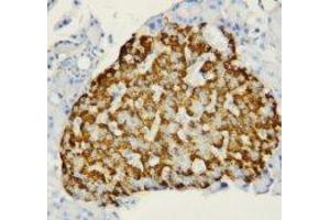 Image no. 1 for anti-Fatty Acid Binding Protein 1, Liver (FABP1) (N-Term) antibody (ABIN1495134) (FABP1 抗体  (N-Term))