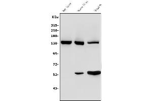 Western blot analysis of Ceruloplasmin/CP using anti-Ceruloplasmin/CP antibody (ABIN3044508). (Ceruloplasmin 抗体  (AA 20-258))