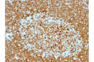 Formalin-fixed, paraffin-embedded human Tonsil stained with CD74 Mouse Monoclonal Antibody (LN-2 + CLIP/813). (CD74 抗体)