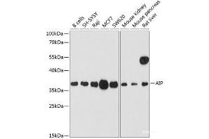 Western blot analysis of extracts of various cell lines using AIP Polyclonal Antibody at dilution of 1:1000. (AIP 抗体)