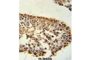 Immunohistochemistry (IHC) image for anti-ERO1-Like beta (ERO1LB) antibody (ABIN3002267) (ERO1LB 抗体)