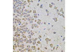 Immunohistochemistry (Paraffin-embedded Sections) (IHC (p)) image for anti-Phosphoinositide-3-Kinase, Catalytic, alpha Polypeptide (PIK3CA) (AA 401-600) antibody (ABIN3020829)