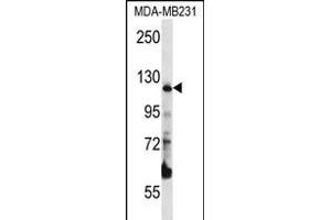 PITRM1 Antibody (Center) (ABIN656324 and ABIN2845623) western blot analysis in MDA-M cell line lysates (35 μg/lane). (PITRM1 抗体  (AA 490-518))
