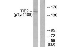 Western blot analysis of extracts from NIH-3T3 cells, using TIE2 (Phospho-Tyr1108) Antibody. (TEK 抗体  (pTyr1108))