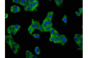 Immunofluorescence staining of HepG2 cells with ABIN7143000 at 1:100, counter-stained with DAPI. (ACCN1 抗体  (AA 197-345))