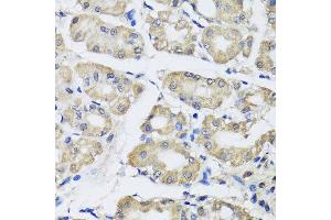 Immunohistochemistry of paraffin-embedded human gastric using SCG3 antibody at dilution of 1:100 (x40 lens). (SCG3 抗体)