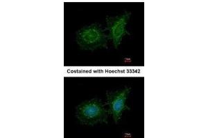 ICC/IF Image Immunofluorescence analysis of methanol-fixed HeLa, using SH3BP1, antibody at 1:200 dilution. (SH3BP1 抗体  (C-Term))
