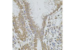 Immunohistochemistry of paraffin-embedded human stomach using HMMR antibody (ABIN5971368) at dilution of 1/100 (40x lens). (HMMR 抗体)