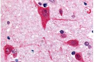 Human Brain, Cortex (formalin-fixed, paraffin-embedded) stained with GPR61 antibody ABIN213359 at 10 ug/ml followed by biotinylated goat anti-rabbit IgG secondary antibody ABIN481713, alkaline phosphatase-streptavidin and chromogen. (GPR61 抗体  (C-Term))