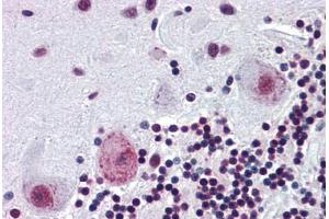 Human Brain, Cerebellum (formalin-fixed, paraffin-embedded) stained with PAX4 antibody ABIN462174 followed by biotinylated goat anti-rabbit IgG secondary antibody ABIN481713, alkaline phosphatase-streptavidin and chromogen. (PAX4 抗体  (AA 166-215))