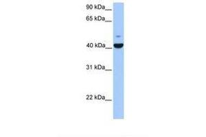 Image no. 1 for anti-FGFR1 Oncogene Partner (FGFR1OP) (AA 81-130) antibody (ABIN6738876) (FGFR1OP 抗体  (AA 81-130))