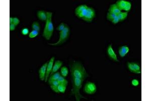 Immunofluorescent analysis of MCF-7 cells using ABIN7152188 at dilution of 1:100 and Alexa Fluor 488-congugated AffiniPure Goat Anti-Rabbit IgG(H+L) (EIF4ENIF1 抗体  (AA 340-630))