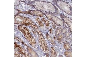 Immunohistochemical staining of human stomach with ZSWIM4 polyclonal antibody  shows granular cytoplasmic positivity in glandular cells at 1:50-1:200 dilution. (ZSWIM4 抗体)