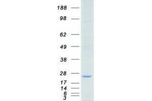 Validation with Western Blot (Dihydrofolate Reductase Protein (DHFR) (Myc-DYKDDDDK Tag))