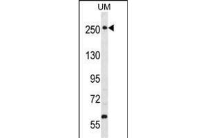 PRKWNK3 Antibody (ABIN391067 and ABIN2841218) western blot analysis in uterus tumor cell line lysates (35 μg/lane). (WNK3 抗体  (C-Term))