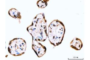 IHC analysis of MSK2/RSK-B/RPS6KA4 using anti-MSK2/RSK-B/RPS6KA4 antibody (ABIN7601238).