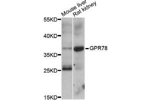 Western blot analysis of extracts of various cell lines, using GPR78 antibody (ABIN5997834) at 1/1000 dilution.