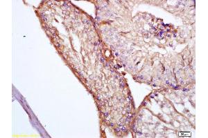 Immunohistochemistry (IHC) image for anti-Clusterin (CLU) (AA 331-449) antibody (ABIN685342)