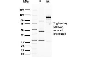 SDS-PAGE Analysis Purified MUC4 Mouse Monoclonal Antibody (MUC4/3105). (MUC4 抗体  (AA 1730-1864))