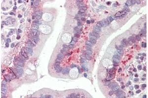 Immunohistochemistry (IHC) image for anti-Solute Carrier Family 25 (Mitochondrial Thiamine Pyrophosphate Carrier), Member 19 (SLC25A19) (AA 236-263) antibody (ABIN1935781)
