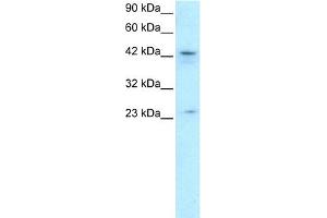 WB Suggested Anti-ZNF365 Antibody Titration:  0. (ZNF365 抗体  (N-Term))