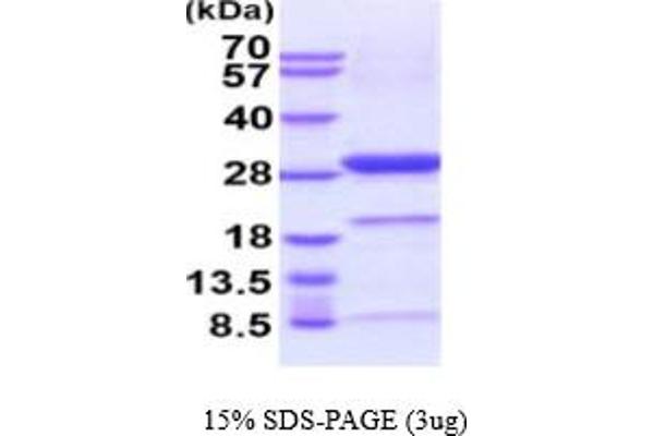 UCHL1 Protein (AA 1-223) (His tag)