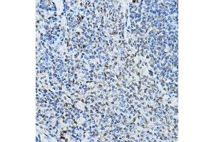 Immunohistochemistry of paraffin-embedded rat spleen using NCOR2 Rabbit pAb (ABIN6130575, ABIN6144422, ABIN6144423 and ABIN6224431) at dilution of 1:100 (40x lens). (NCOR2 抗体  (AA 670-900))