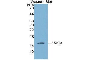 Western Blotting (WB) image for anti-Angiogenic Factor with G Patch and FHA Domains 1 (AGGF1) (AA 406-501) antibody (ABIN1866581) (AGGF1 抗体  (AA 406-501))