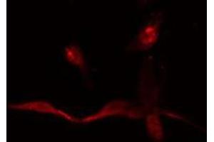 ABIN6275065 staining  HepG2 cells by IF/ICC. (TdT 抗体  (Internal Region))
