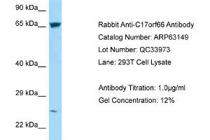 Western Blotting (WB) image for anti-Chromosome 17 Open Reading Frame 66 (C17orf66) (C-Term) antibody (ABIN2789392) (C17orf66 抗体  (C-Term))
