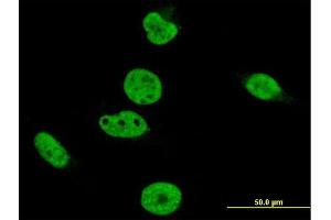 Immunofluorescence of monoclonal antibody to CRKRS on HeLa cell. (CDK12 抗体  (AA 1281-1380))