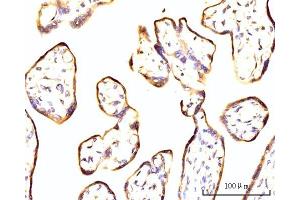 IHC analysis of RPL11 using anti-RPL11 antibody (ABIN7602315). (RPL11 抗体  (AA 7-178))