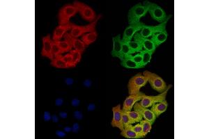ABIN7094511 and ABIN7098560 staining Hela cells by IF/ICC.