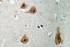 Immunohistochemistry (IHC) analyzes of Annecin I antibody in paraffin-embedded human brain tissue. (Annexin a1 抗体)