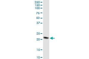 Western Blotting (WB) image for anti-NADH Dehydrogenase (Ubiquinone) 1 beta Subcomplex, 10, 22kDa (NDUFB10) (AA 1-172) antibody (ABIN518243)