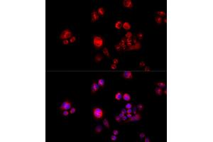 Immunofluorescence analysis of HeLa cells using GLUD2 antibody (ABIN5973969) at dilution of 1/100 (40x lens). (GLUD2 抗体)