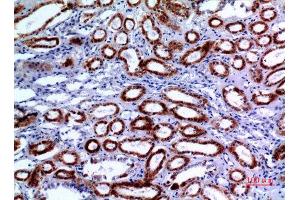 Immunohistochemistry (IHC) analysis of paraffin-embedded Human Kidney, antibody was diluted at 1:100. (XRCC6 抗体  (Ser408))