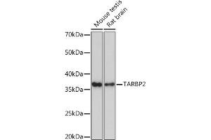 Western blot analysis of extracts of various cell lines, using T Rabbit mAb (ABIN7270729) at 1:1000 dilution. (TARBP2 抗体)