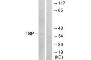 Western blot analysis of extracts from 293 cells, using TBP Antibody. (TBP 抗体  (AA 151-200))