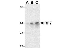 Image no. 1 for anti-Interferon Regulatory Factor 7 (IRF7) (C-Term) antibody (ABIN265129) (IRF7 抗体  (C-Term))